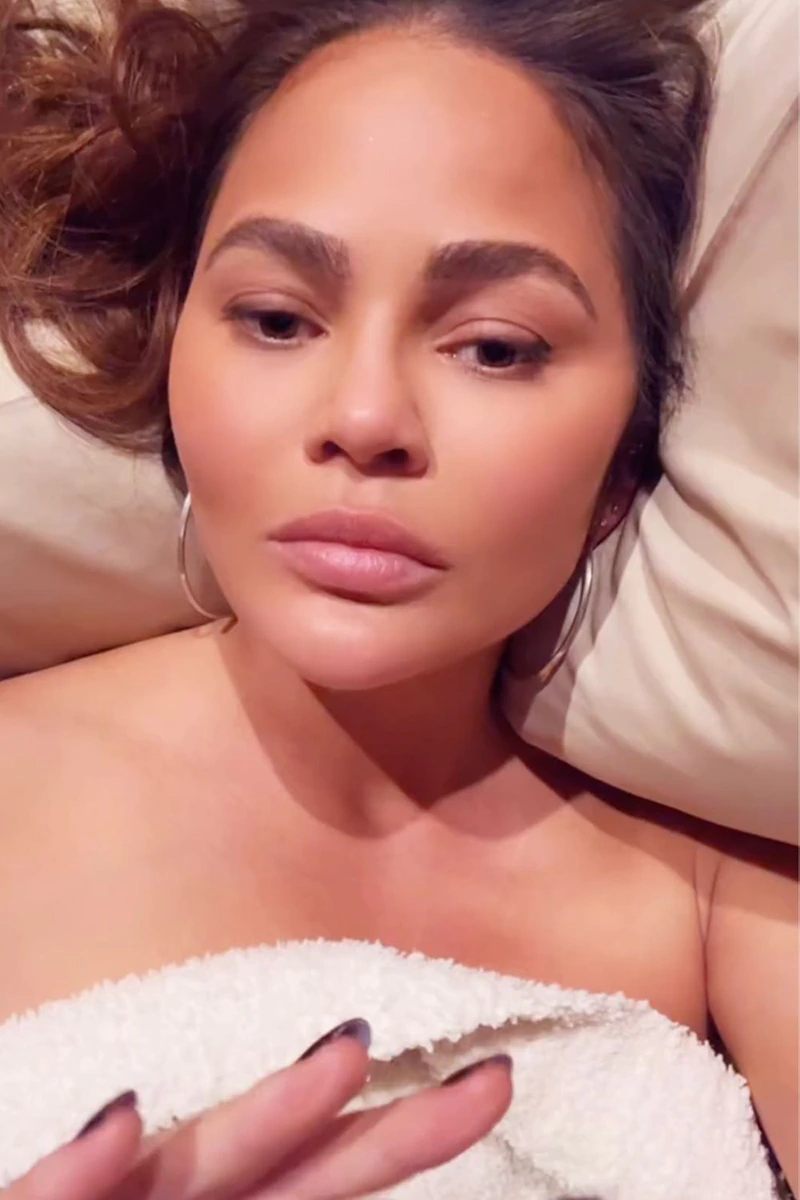 Chrissy Teigen