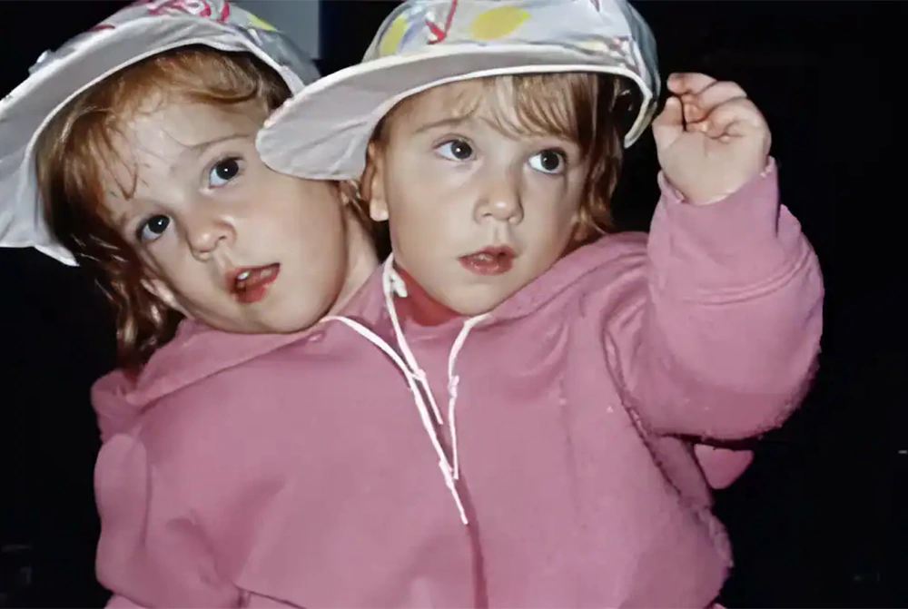 Hensel twins