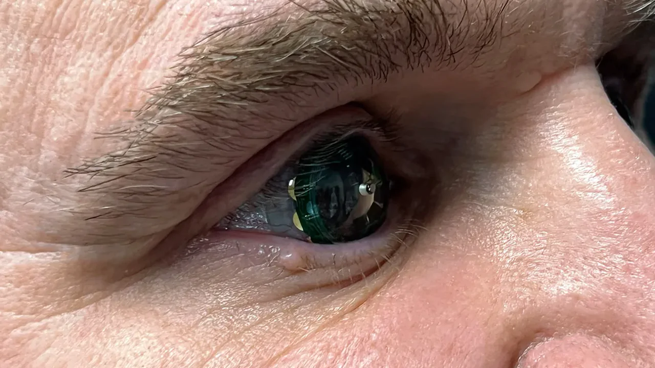 Mojo Vision CEO uses Mojo Lens