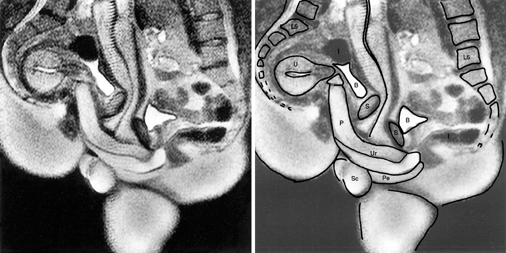An image of the MRI, and a labelled one.