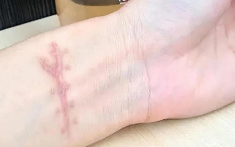 A kiss that saved a life.